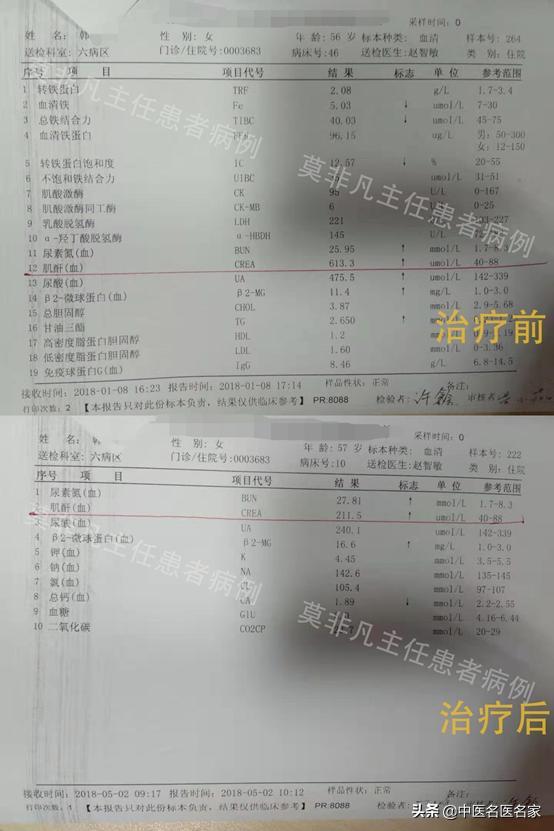 慢性肾衰竭是尿毒症的预备军，56岁的肾衰阿姨却赢了这场战斗 鹿血片 第2张
