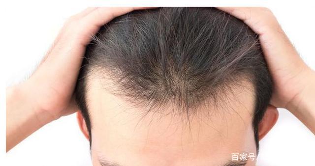 肾脏由盛到衰的3个特征，若你一个没有，说明你身体非常好 鹿血片 第2张