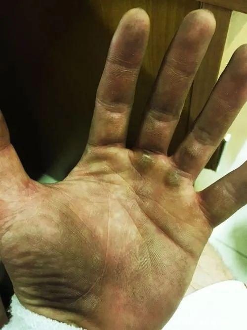 手淫对身体有益，但不宜过于频繁，常喝一种水，可改善你的肾动力 鹿血片 第5张