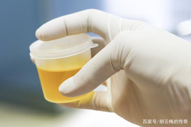 夫妻早上“爱爱”好处多，肾不好怎么行？保护好肾脏，夫妻更亲密 鹿血片 第7张