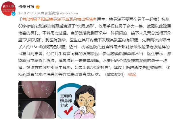  阳后出现“水泥封鼻”，医生最怕你这样擤鼻涕…… 鹿血片 第1张